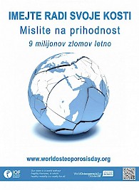 Imejte radi svoje kosti